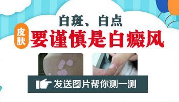 为什么腿上皮肤会有白斑